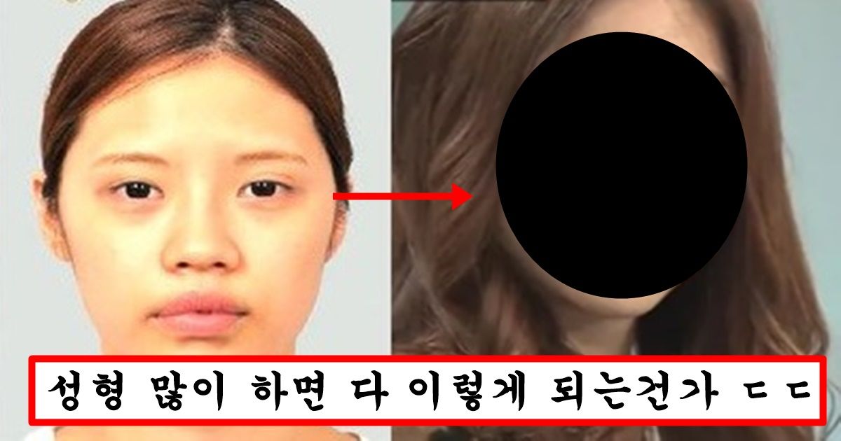 예뻐지고 싶어서 성형수술 30번 해버린 한국인 여성의 최후