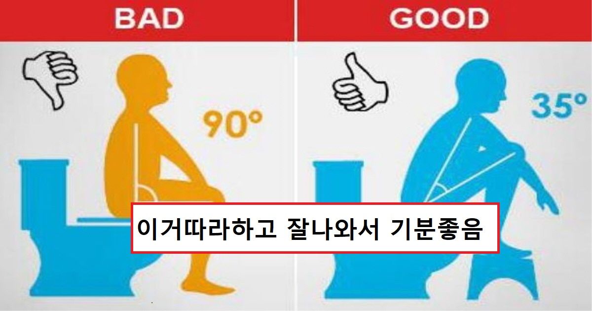 변비자들을 위한 쾌변을 부르는 배변자세