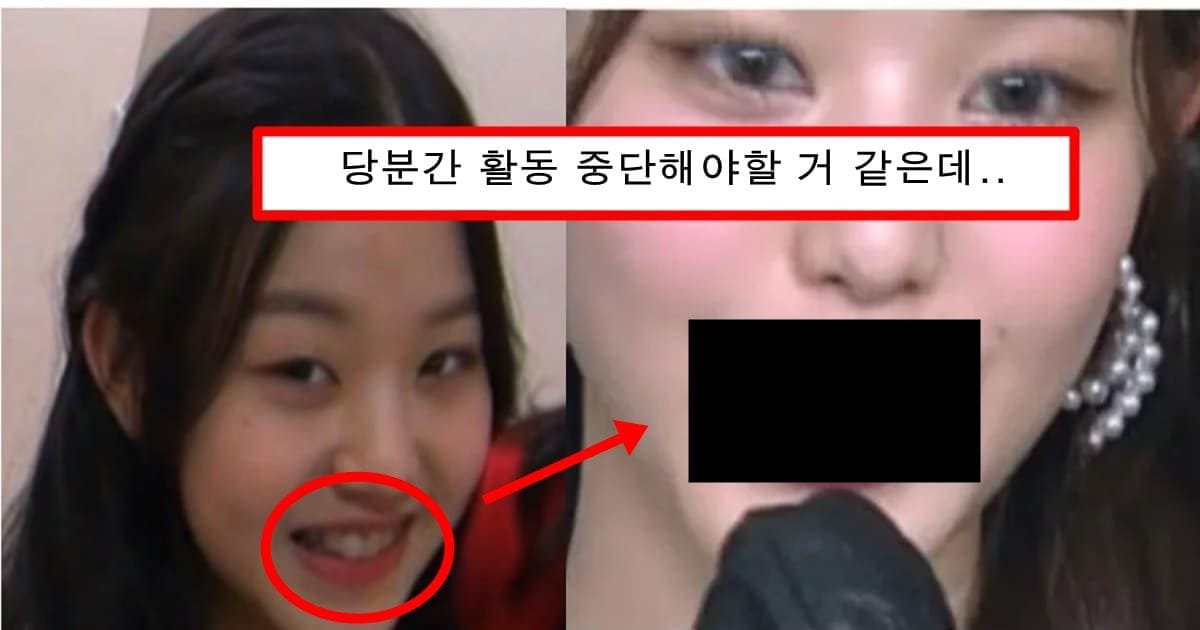 정 부작용으로 입 삐뚫어져서 활동 중단 위기까지 노였다는 장원영 심각한 상태