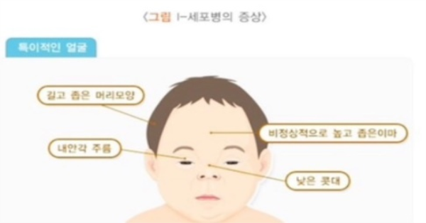 희귀병 치료제를 위해 이재용 인스타로 디엠을 보낸 결과